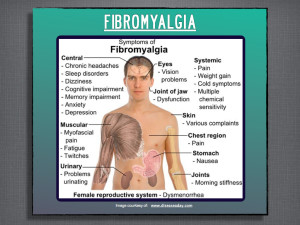 Description of some of the symptoms of Fibromyalgia.